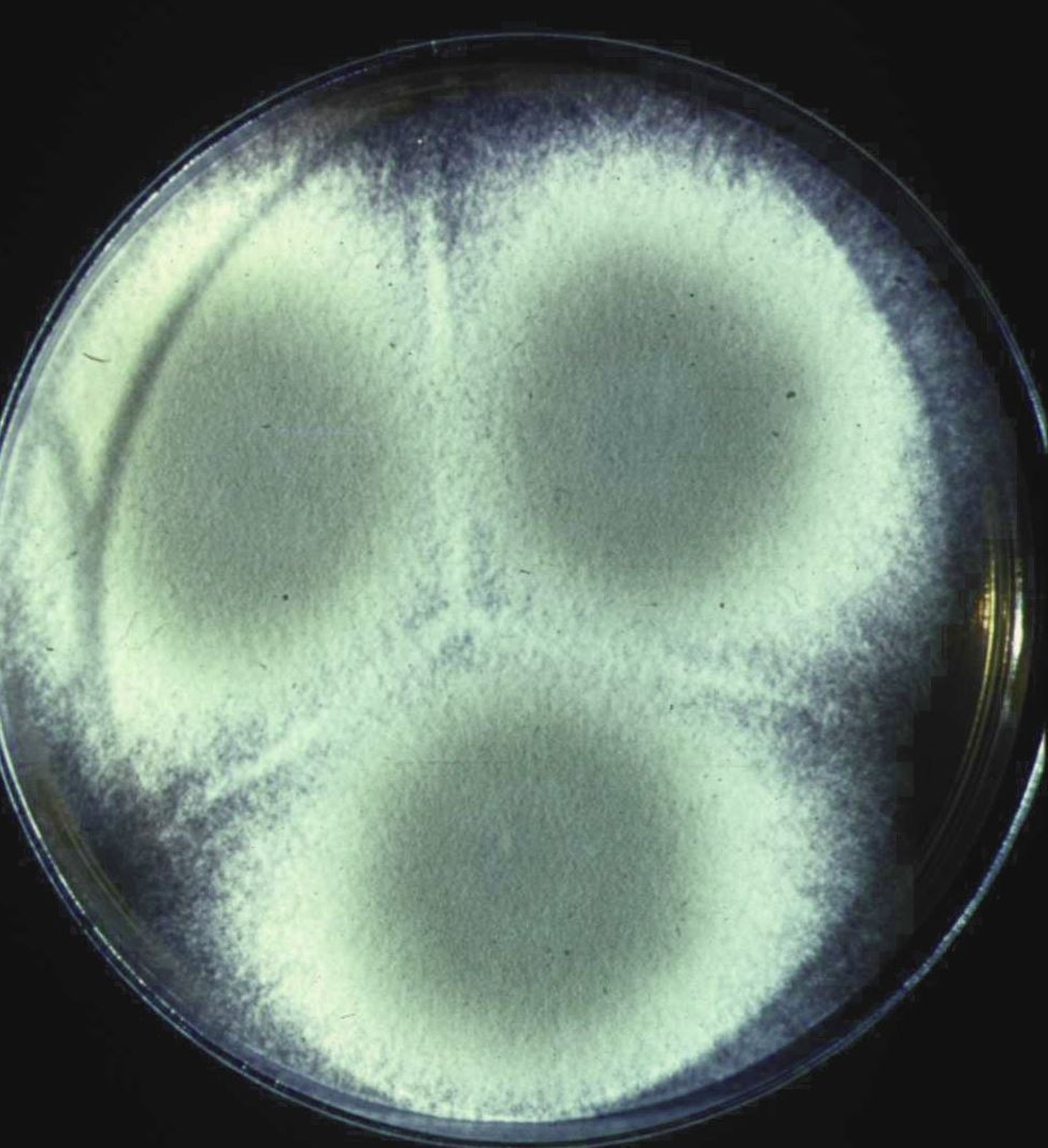 Penicillium digitatum in ambiente domestico