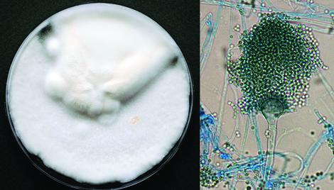 Aspergillus_felis.jpg