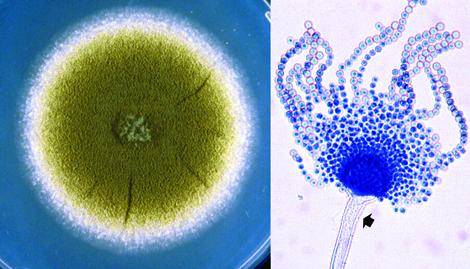 Aspergillus_flavus.jpg