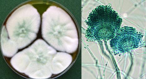 Aspergillus_lentulus.jpg