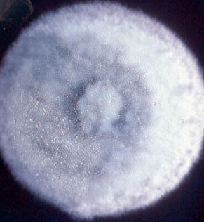 Coccidioides immitis-2