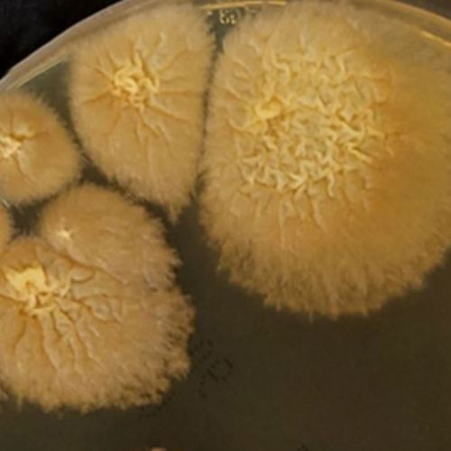 Coniochaeta hoffmannii-2