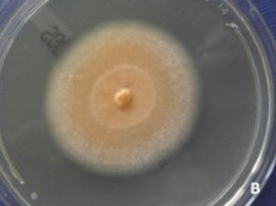 Seconda immagine Fusarium dimerum &ndash; fialidi rigonfie corti su piastra di coltura