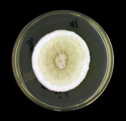 Scedosporium_apiospermum.jpg